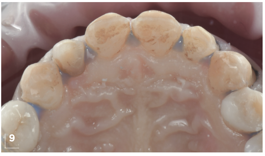 Figure 9
