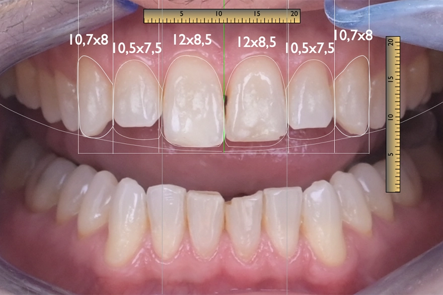 formation plans de traitements dentaire digital smile design