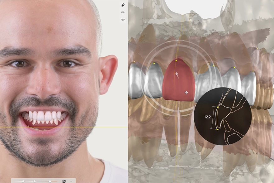 formation plans de traitements dentaire smilecloud